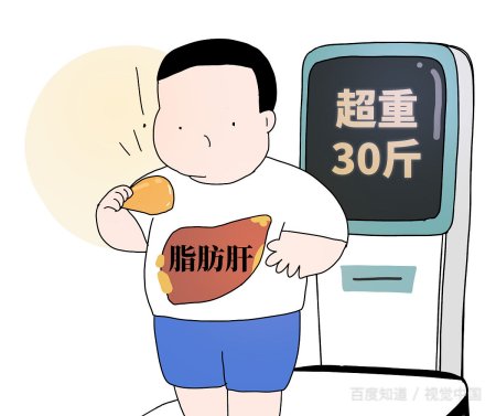 什么是脂肪肝？