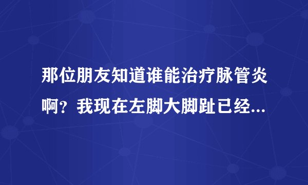 那位朋友知道谁能治疗脉管炎啊？我现在左脚大脚趾已经溃烂了，疼得要命啊！！求好心人告诉我那能治疗脉管