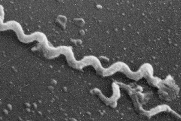 俄国13外17外eet出血