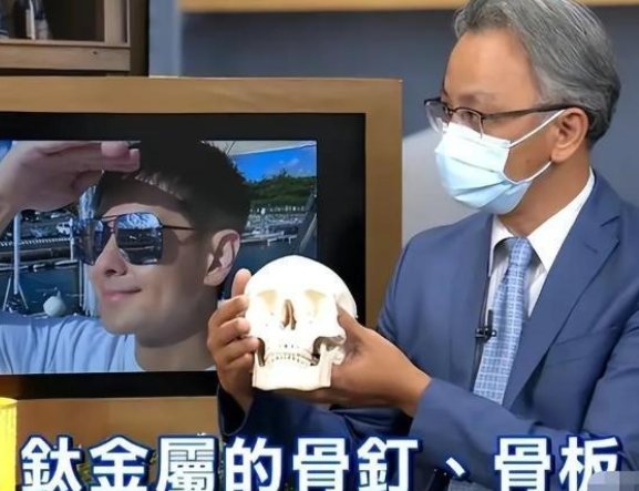 院方透露林志颖已返家休养，已可自行饮食！这起事故带来的影响有多大？