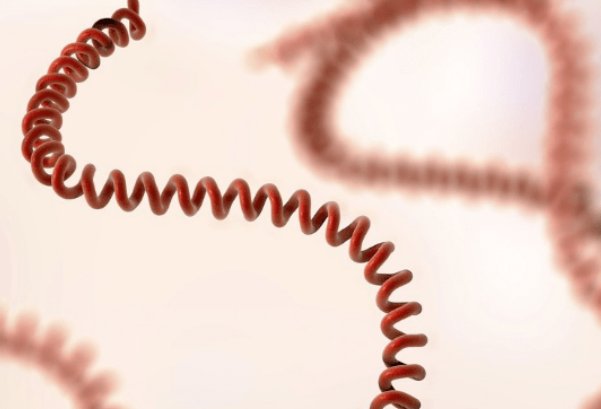 俄国13外17外eet出血