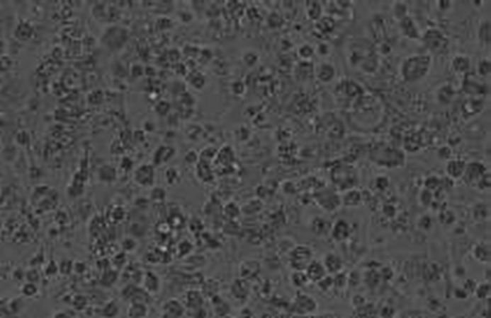 德尔塔变异毒株在继续变异和进化，这一病毒的传染性有多强？