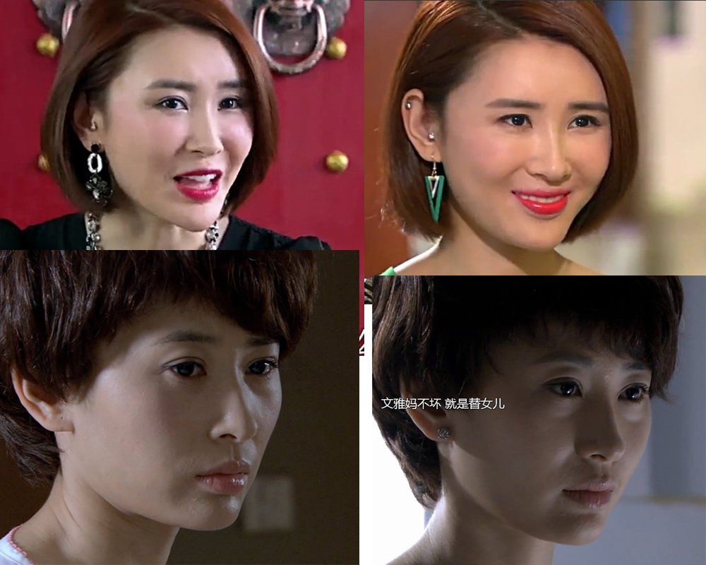 吕夏葳整容过吗？感觉她面目表情僵硬怀疑整容的。