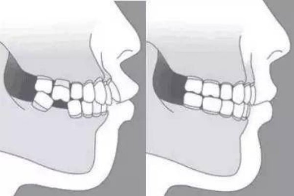龌龊龃龉怎么读