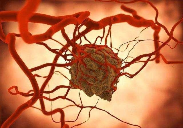 癌胚抗原到底是什么意思？指标一般是多少呢？