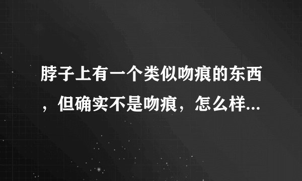 脖子上有一个类似吻痕的东西，但确实不是吻痕，怎么样才能证明不是呢？