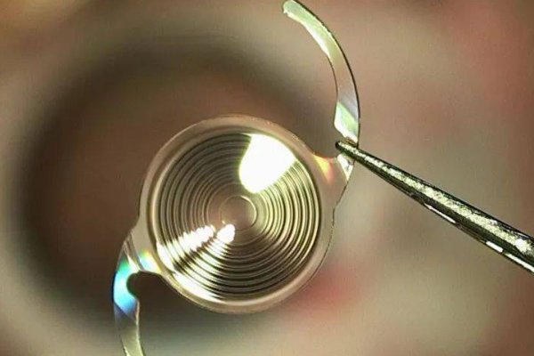 进口人工晶体排名