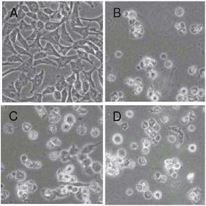 质粒拯救的介绍