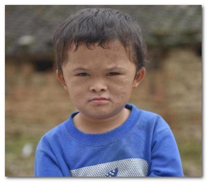 小马云被鉴定为二级智力残疾，他的后半生该如何度过？