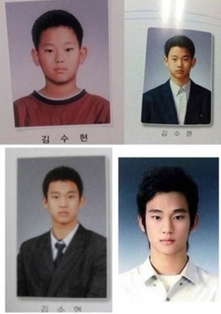 金秀贤真的整容了吗