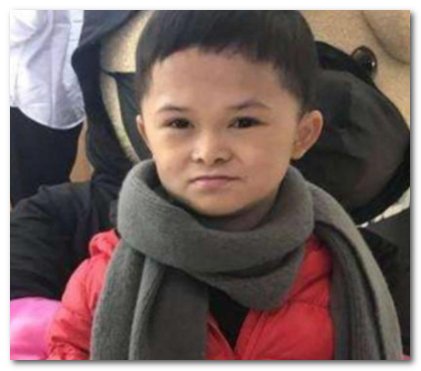 小马云被鉴定为二级智力残疾，他的后半生该如何度过？