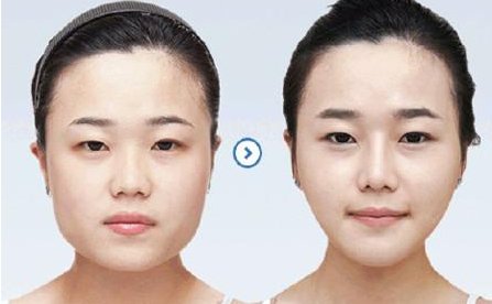 怎样瘦脸（国字脸好难看）