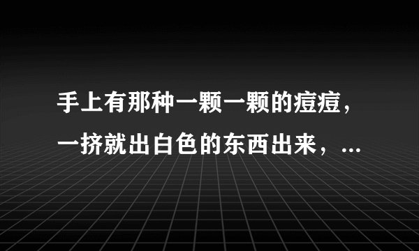 手上有那种一颗一颗的痘痘，一挤就出白色的东西出来，这是不是过敏啊？还是.....