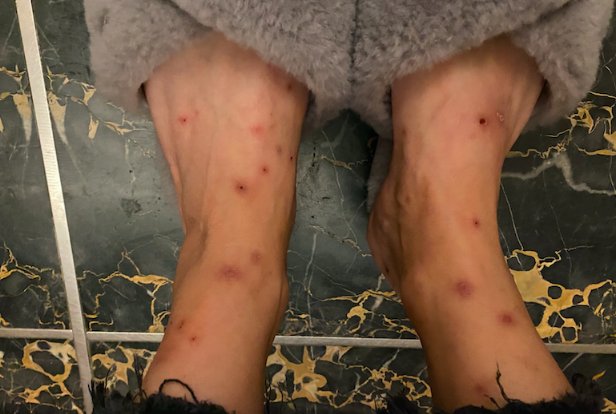 北京一小区跳蚤泛滥，居民苦不堪言，跳蚤究竟是从何而来的？