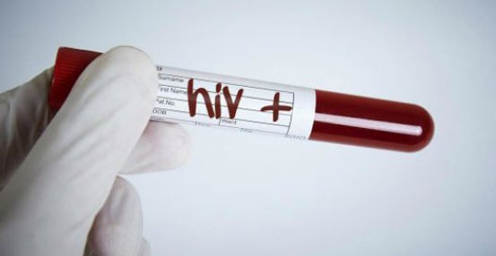 成都一医院六旬勤杂工感染艾滋病，他为什么会被感染？