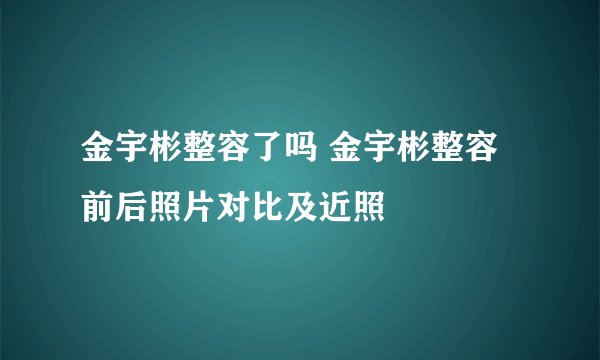 金宇彬整容了吗 金宇彬整容前后照片对比及近照
