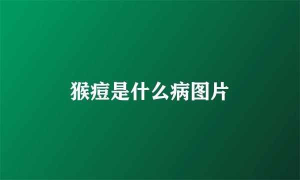 猴痘是什么病图片