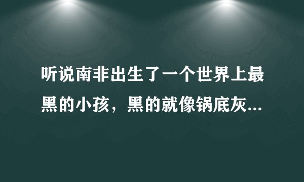听说南非出生了一个世界上最黑的小孩，黑的就像锅底灰一样，是真的吗？