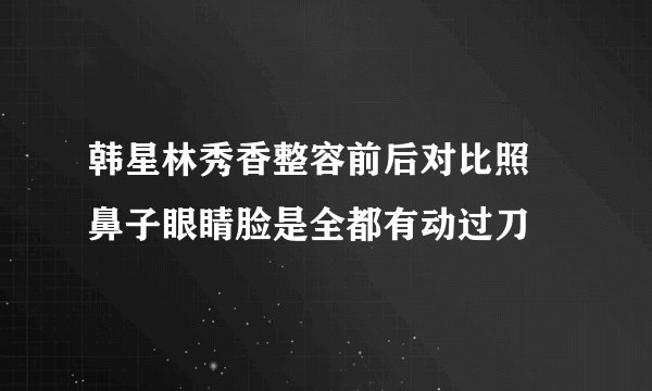 韩星林秀香整容前后对比照 鼻子眼睛脸是全都有动过刀