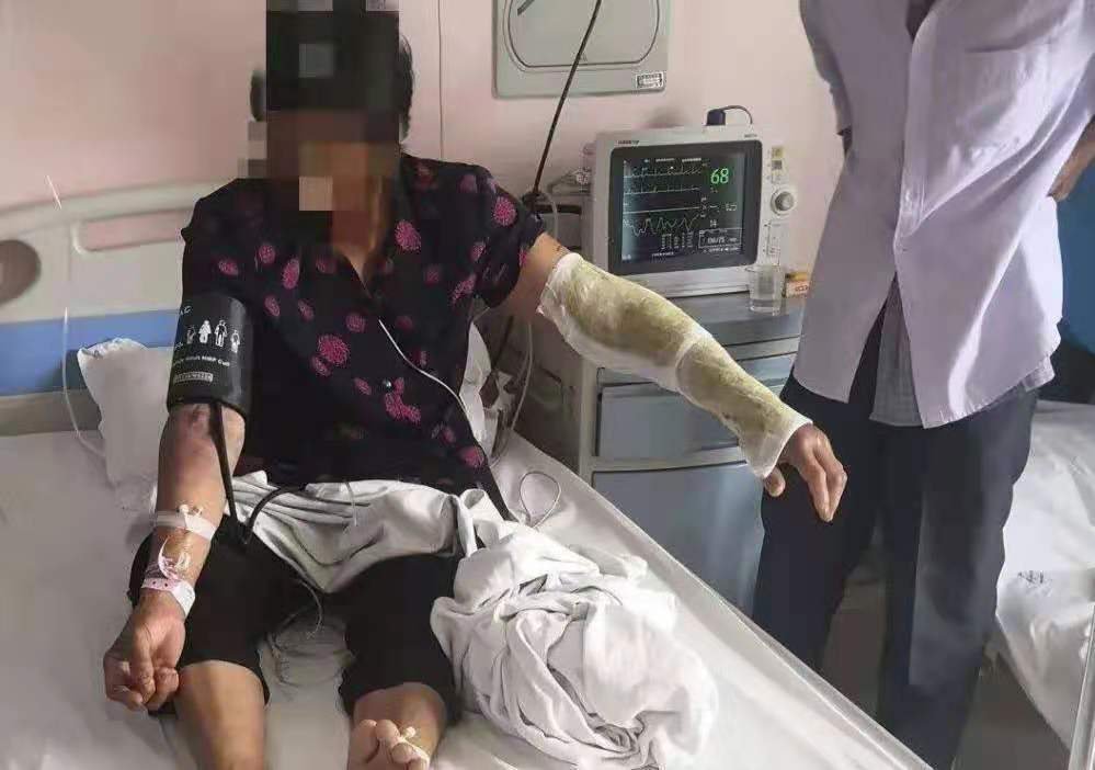 重庆的一位女子江边散步被蛇咬伤,女子是否有生命危险?