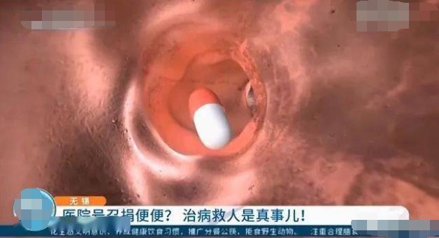 江苏一医院号召捐便便救人，500元一坨，各位有想法吗？